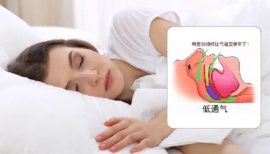 最新专家共识：CVD 合并OSA患者应首选无创 CPAP 治疗！